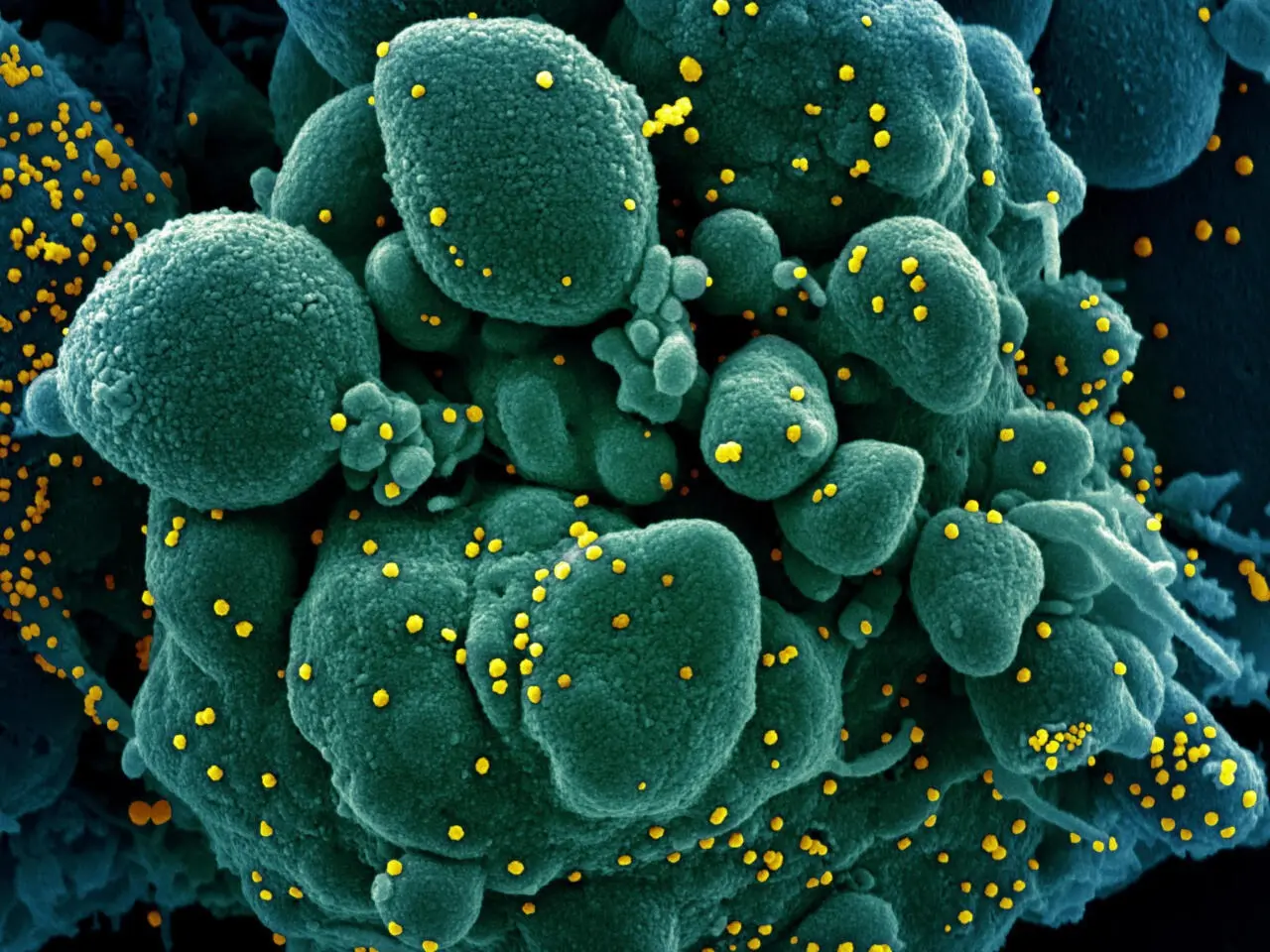 Virus