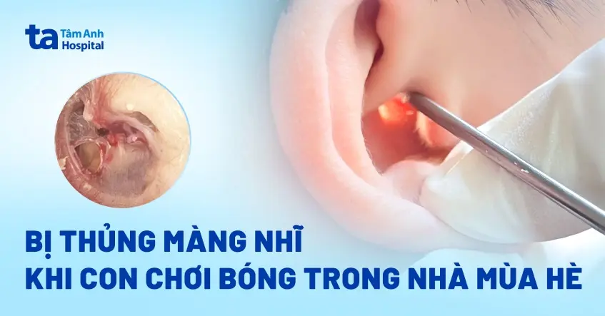 gfiz1a bi thung mang nhi do va dam
