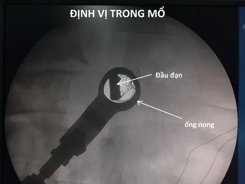 l4zaxr dinh vi dau dan 1583117824908341235749