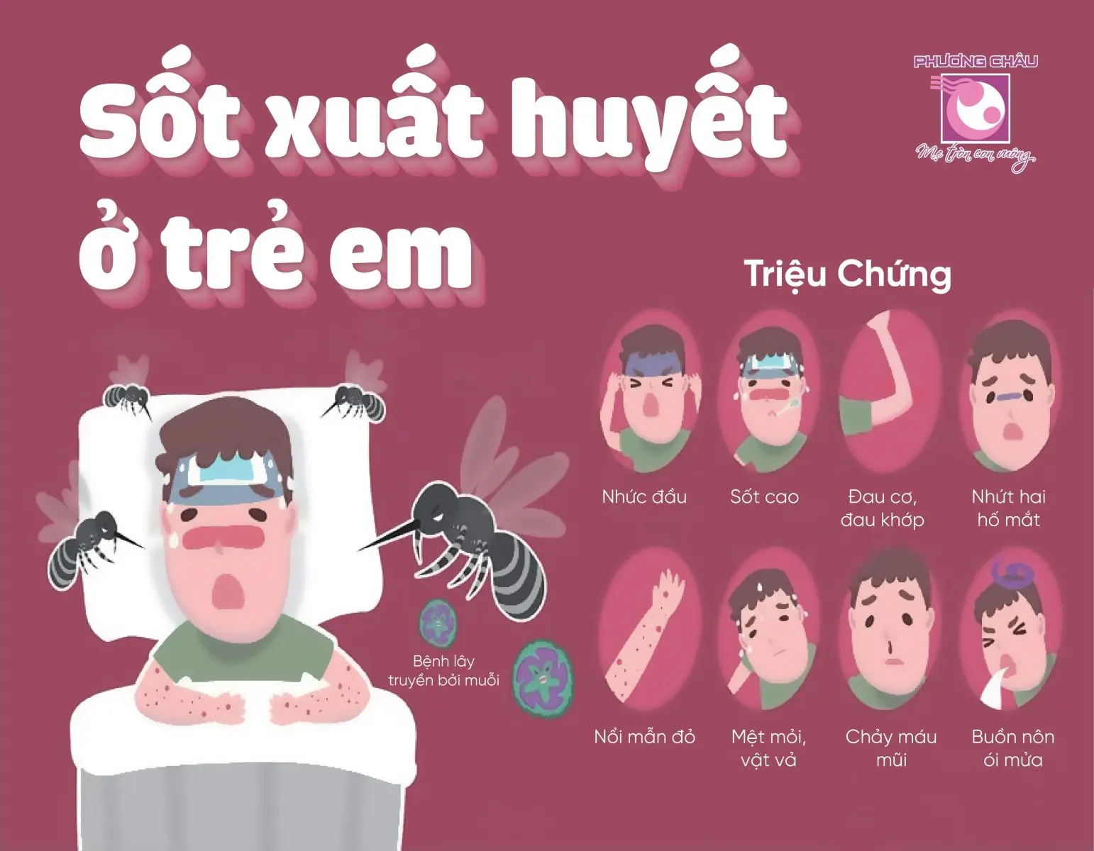 xyxw1u sot xuat huyet o tre em
