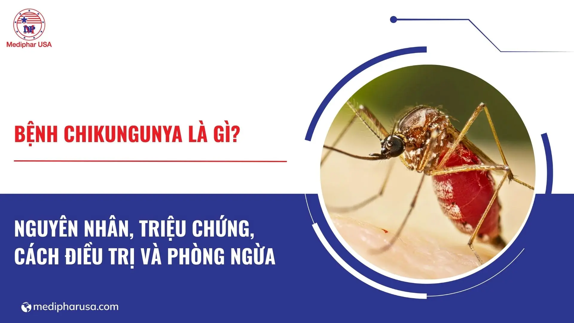 30413z benh chikungunya