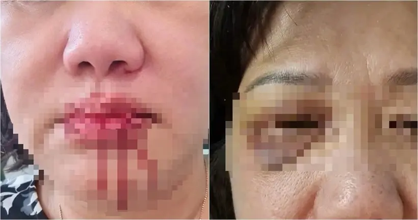 9dsfez nguoi phu nu 60 tuoi bi 2 vo chong hanh hung tai sanh chung cu o tp hcm3jpg 20592313