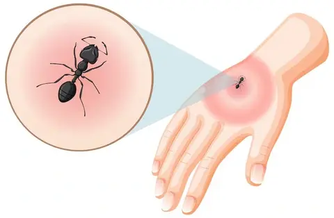 bj7dws thuc hu chuyen kien giup xua duoi muoi truyen benh chikungunya 17563084689561311662589