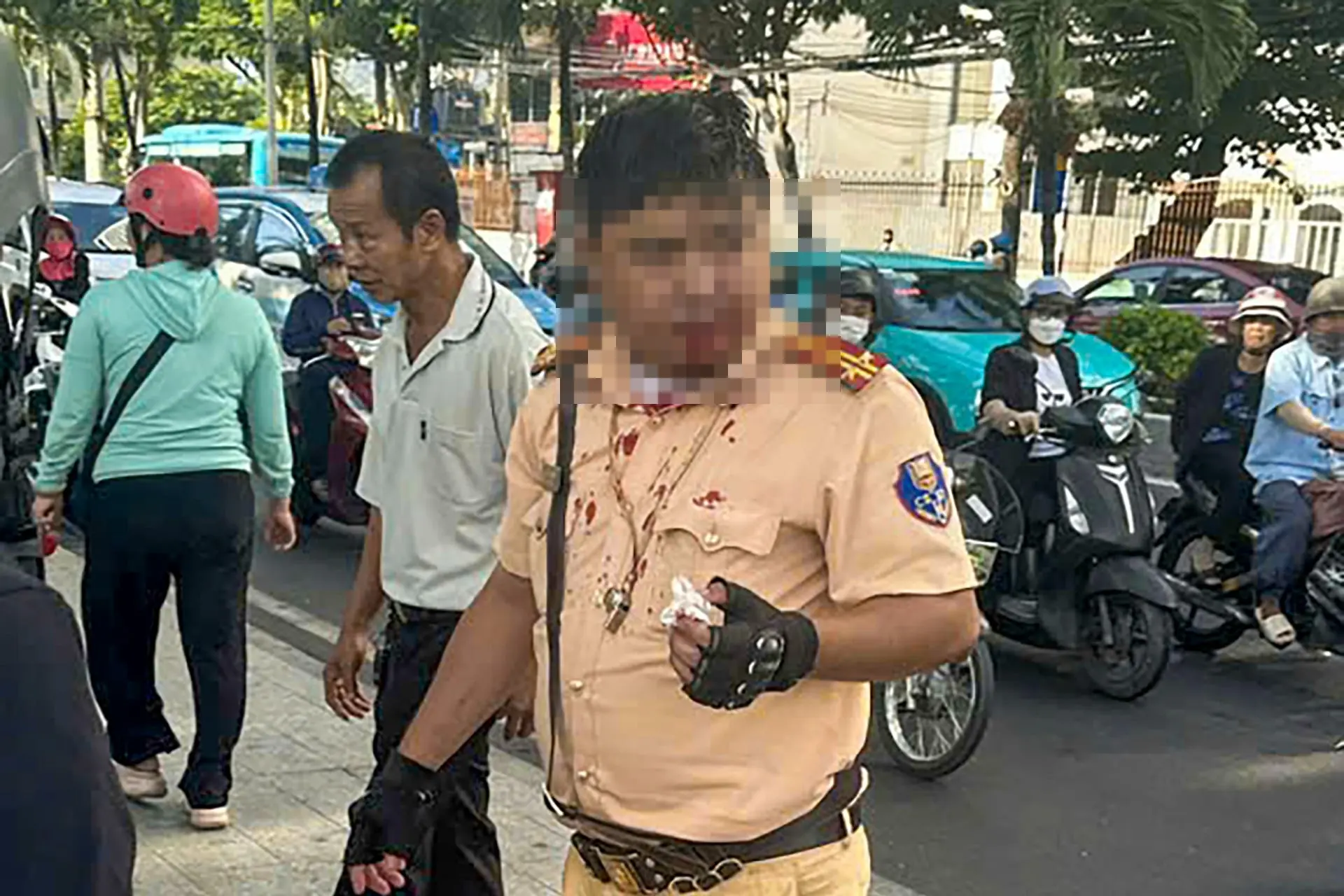 c208mg trung ta csgt o nha trang bi nguoi nuoc ngoai dam vao mat khi dang lam nhiem vu 2645
