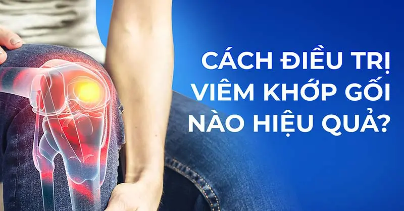 pzpgsc cach dieu tri viem khop goi