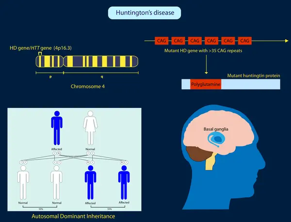 3kzc70_huntingtondisease7249287818-1.webp