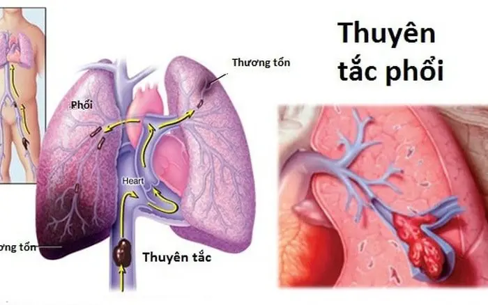 7of8k5 thuyen tac phoi1 17129815288191578261803