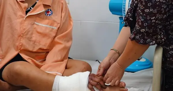 lulrpp thai phu gap tai nan bac si ghep tam ban tay vao cang chan cho ngay noi lai 1542