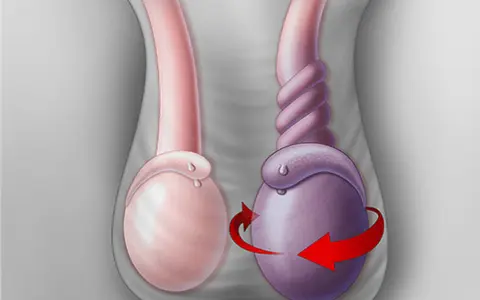 2vw28m 20210910chan doan va dieu tri benh xoan tinh hoan 1 1727402085285500041739 20 0 520 800 crop 17274021011091944363121