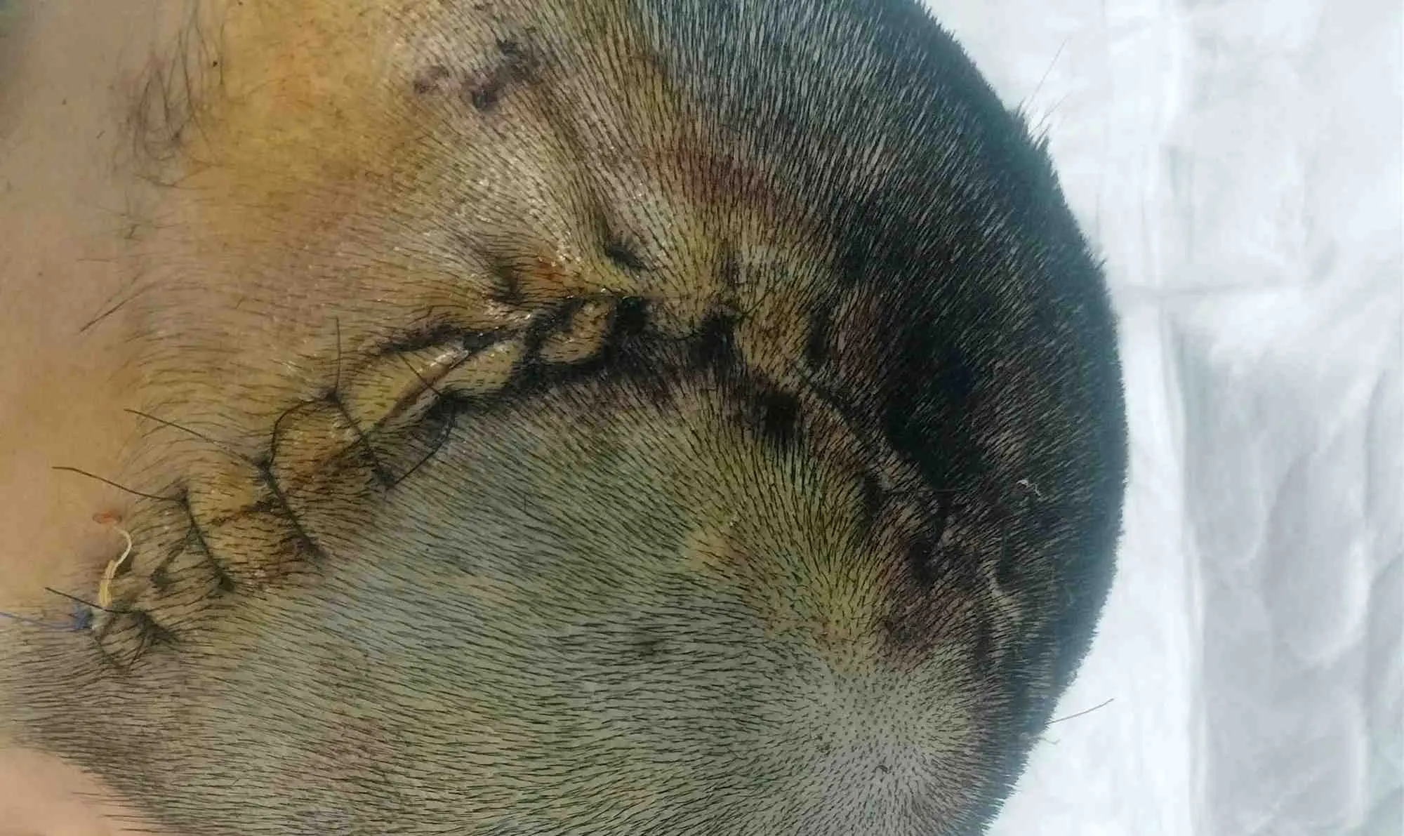 eaksdp B12 Under150kb