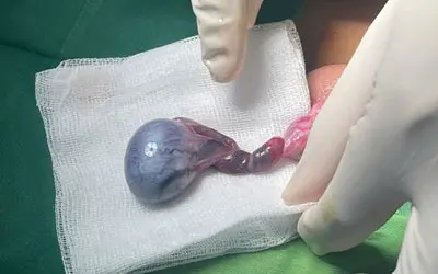 i9l0js tinh hoan 1731040022431237758691 95 0 345 400 crop 17310402514871505494290