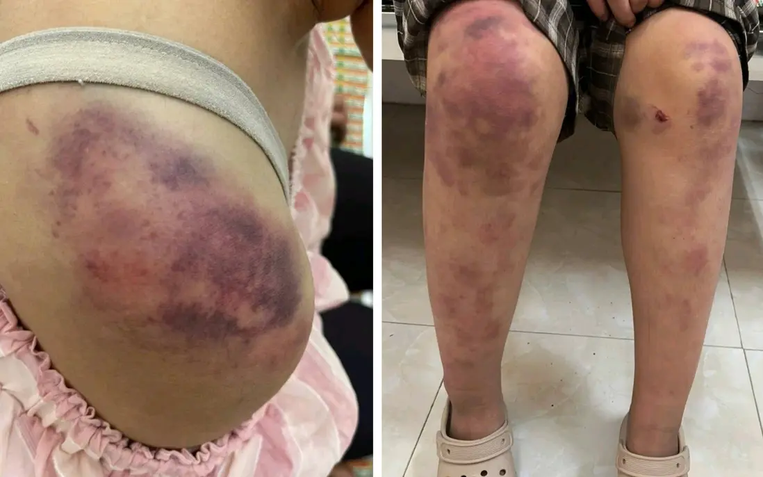 mcxw74 1000029741 17636236639321371553433 106 0 1356 2000 crop 17636236732861546140443