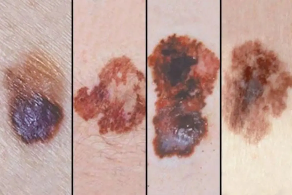 uumahu u hac to ac tinh edited 1762875173371