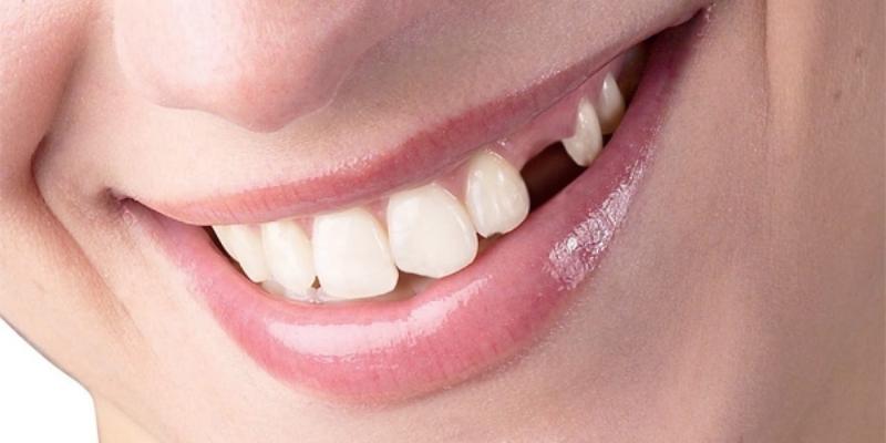 Cụ thể nằm mơ thấy rụng răng đánh số mấy?